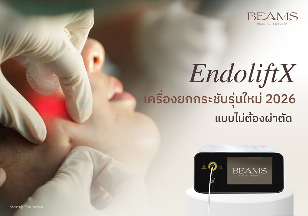 EndoliftX เครื่องยกกระชับรุ่นใหม่ 2026
