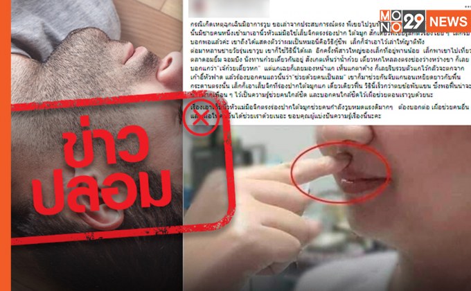 ข่าวปลอม! ใช้นิ้วหัวแม่มือจิกร่องระหว่างปากและใต้จมูก ช่วยคนที่วูบหมดสติ ให้ฟื้นคืน