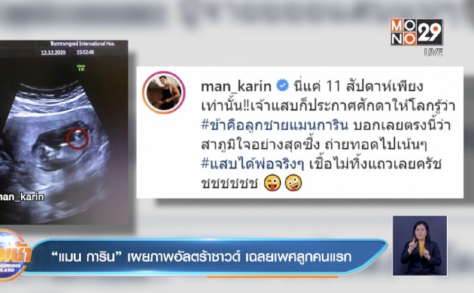 “แมน การิน” เผยภาพอัลตร้าซาวด์ เฉลยเพศลูกคนแรก