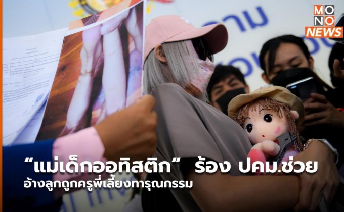 “แม่เด็กออทิสติก“  ร้อง ปคม.ช่วย อ้างลูกถูกครูพี่เลี้ยงทารุณกรรม