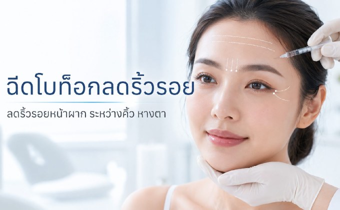 รู้จักฉีดโบลดริ้วรอย ผลลัพธ์ ข้อดี ข้อจำกัด และราคาแต่ละตำแหน่ง