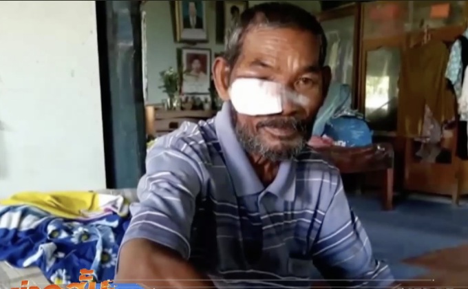 สุนัขจรจัดกัดเด็ก 3 ขวบและชาวบ้านบาดเจ็บสาหัส