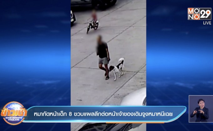 หมากัดหน้าเด็ก 8 ขวบแผลลึกต่อหน้าเจ้าของเดินจูงหมาหนีเฉย