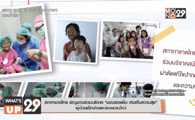 สภากาชาดไทย เชิญชวนร่วมบริจาค “มอบรอยยิ้ม เติมเต็มความสุข”  ผู้ป่วยเด็กปากแหว่งเพดานโหว่