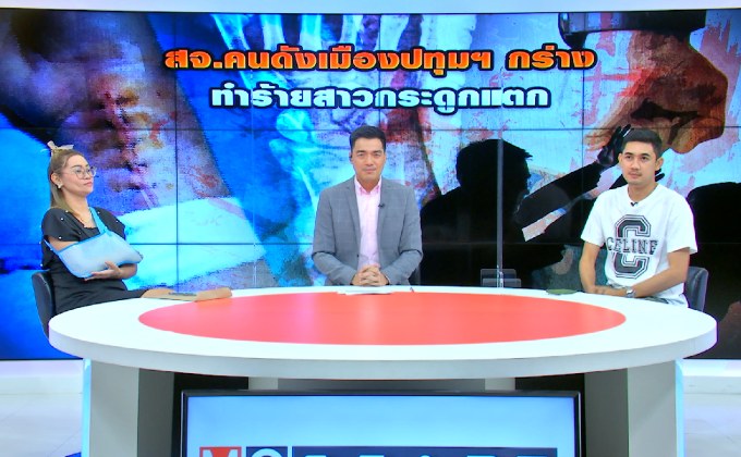 “สจ.คนดังเมืองปทุมฯ กร่าง ทำร้ายสาวกระดูกแตก”