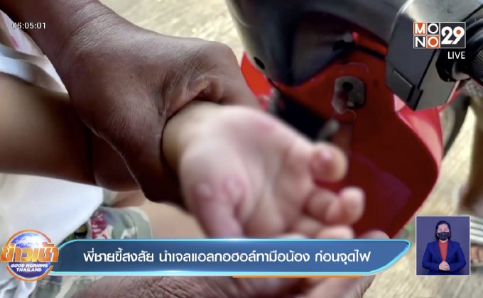 พี่ชายขี้สงสัย นำเจลแอลกอฮอล์ทามือน้อง ก่อนจุดไฟ