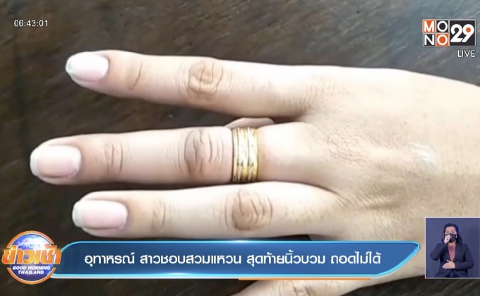 อุทาหรณ์ สาวชอบสวมแหวน สุดท้ายนิ้วบวม ถอดไม่ได้