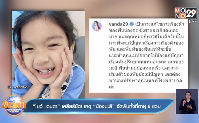 “โบว์ แวนดา” เคลียร์ชัด! เหตุ “น้องมะลิ” จัดฟันทั้งที่อายุ 6 ขวบ