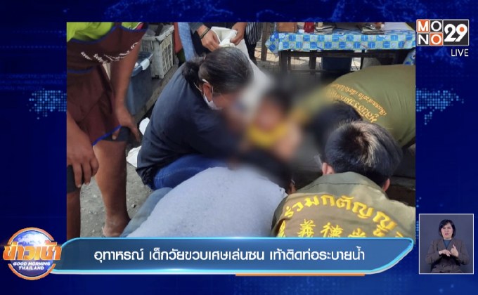 อุทาหรณ์ เด็กวัยขวบเศษเล่นซน เท้าติดท่อระบายน้ำ