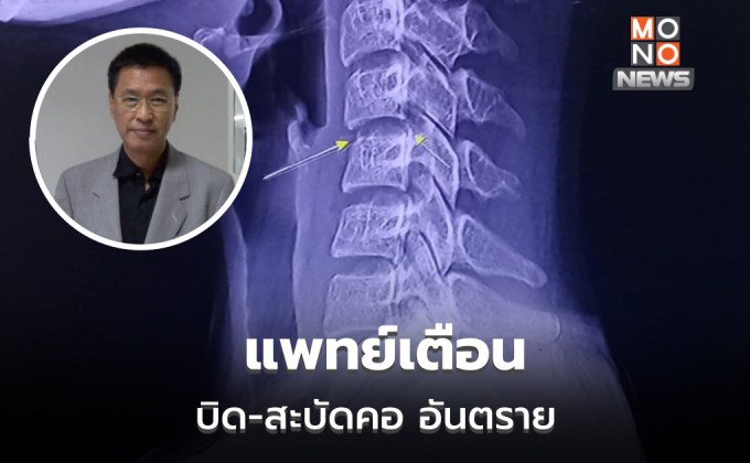 แพทย์เตือน บิด สะบัดคอ อันตราย