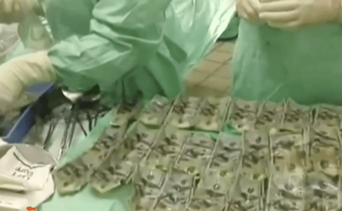 หญิงโคลอมเบียกลืนธนบัตรกว่า 7,000 ดอลลาร์