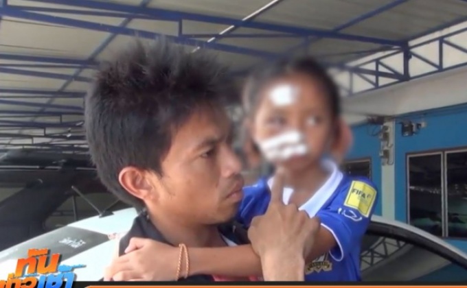 ร้องสื่อฯ ลูกสาว 8 ขวบถูกสุนัขกัด แต่ไร้คนรับผิดชอบ