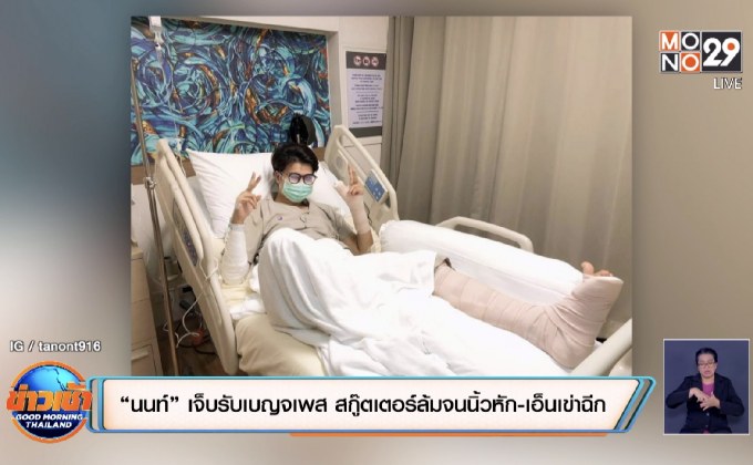 “นนท์” เจ็บรับเบญจเพส สกู๊ตเตอร์ล้มจนนิ้วหัก-เอ็นเข่าฉีก